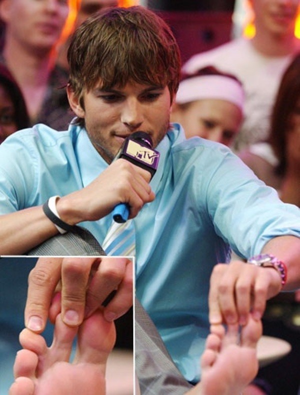 Fešák Ashton Kutcher ma dva zrastené prsty na nohe
